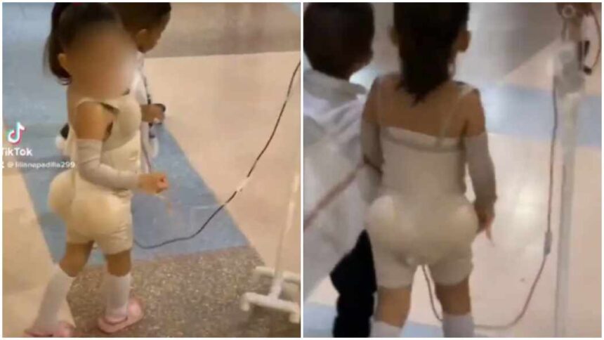 Disfrazaron a una niña de paciente recién salida de una cirugía estética y escadalizó a todos en redes +VIDEO